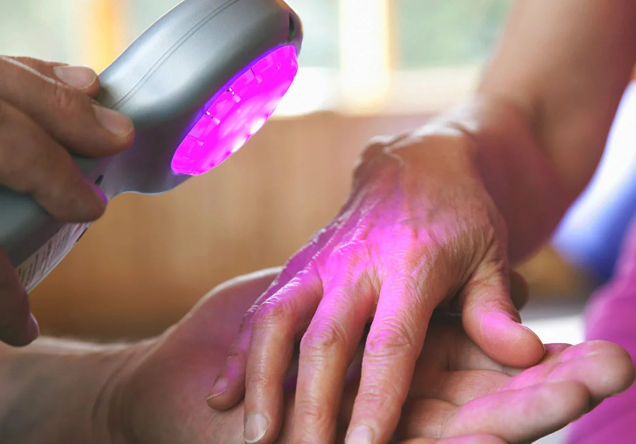Laser Therapy