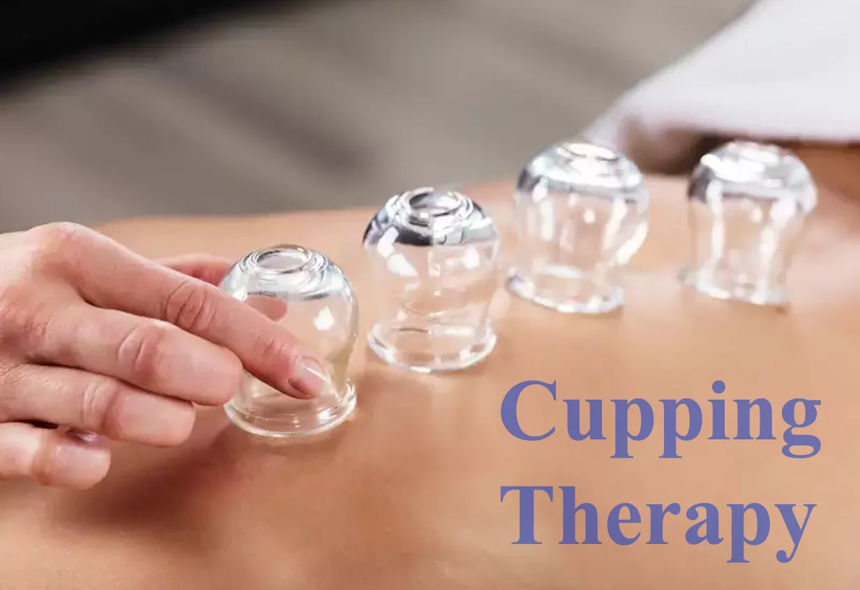 Cupping Therapy